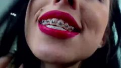 Provocative Latina With Red Lips And Metal Braces, Super Hot!