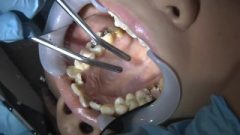 Nippon Dental Fetish 2
